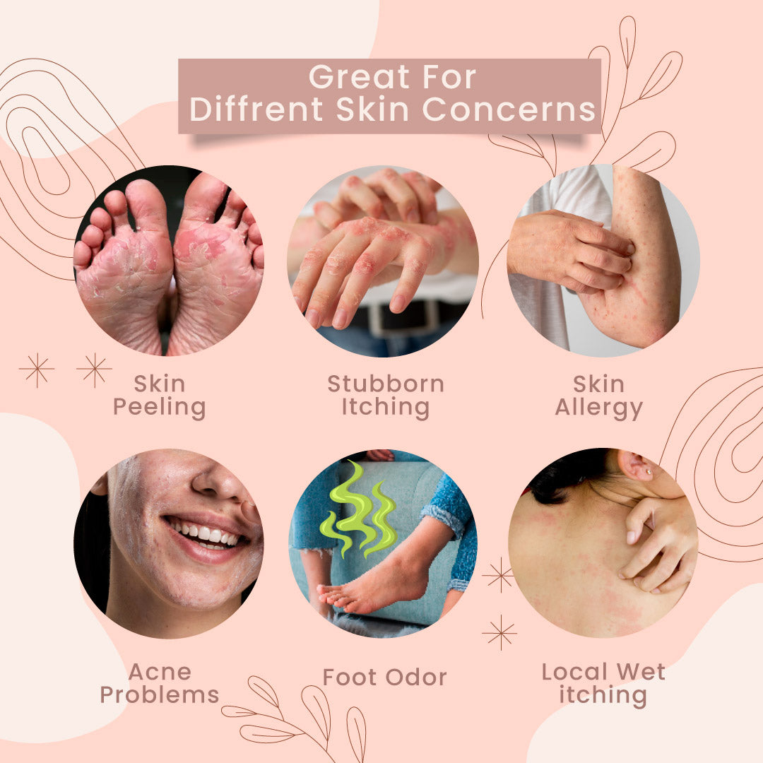 Herbal Eczema & Psoriasis Relief Cream